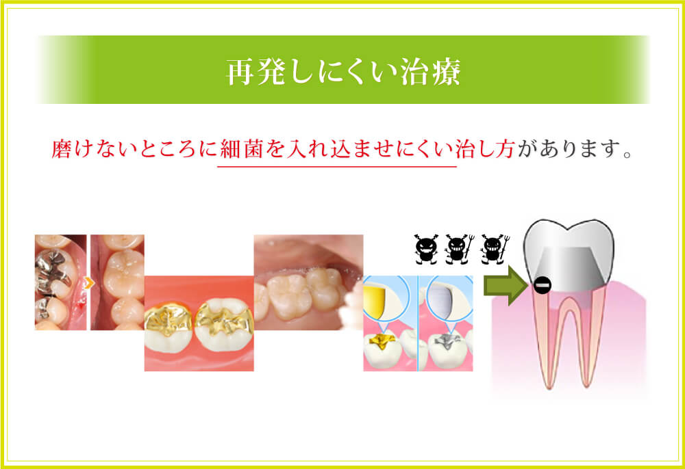 再発しにくい治療