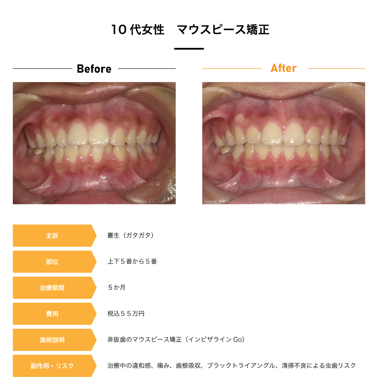 Case1