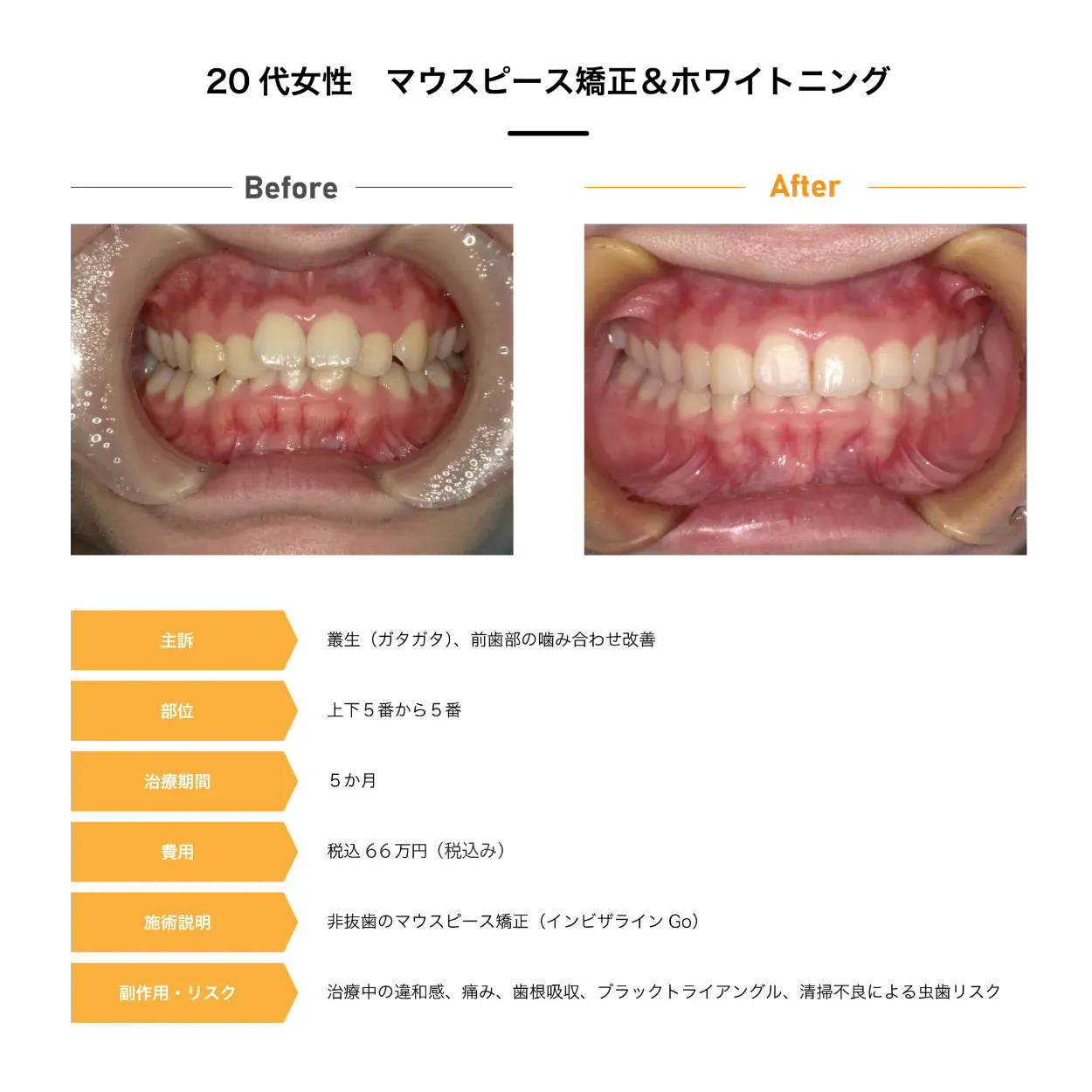 Case4