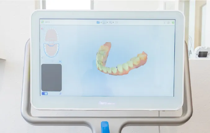 検査データの送信