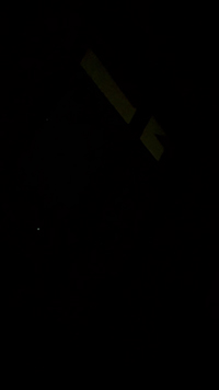 小児矯正